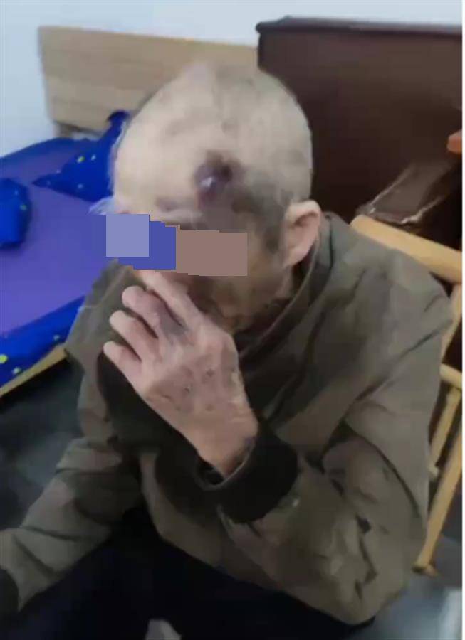 皇冠皇冠信用代理_广东阳江一养老院护工长期虐待九旬老人?民政局已介入皇冠皇冠信用代理,警方:正了解情况