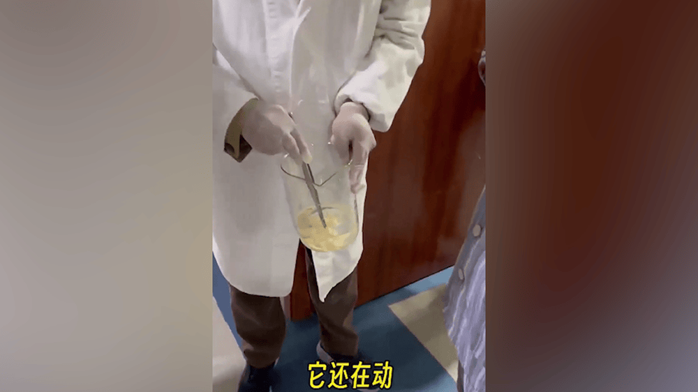 皇冠信用平台出租出售_女子肛门处刺痒难忍皇冠信用平台出租出售,医院用“南瓜籽+槟榔”驱虫排出长达10米寄生虫