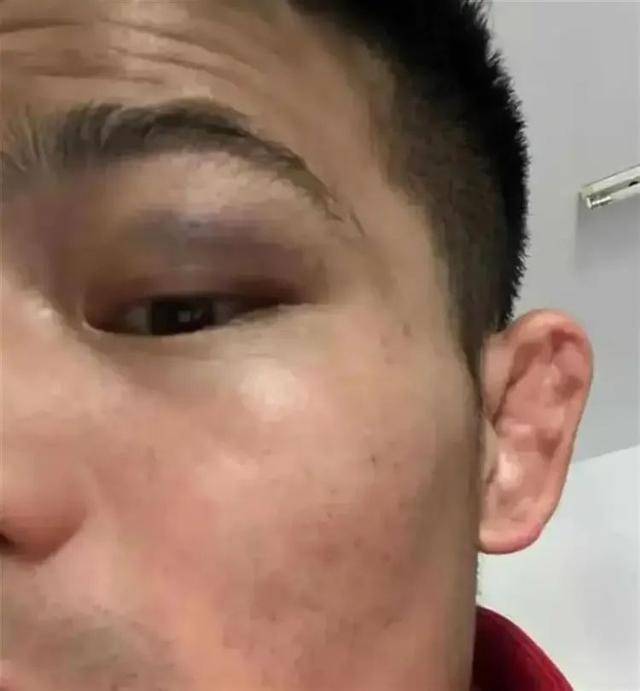 皇冠信用盘平台出租_全国散打季军称遭多名运动员群殴皇冠信用盘平台出租?官方通报