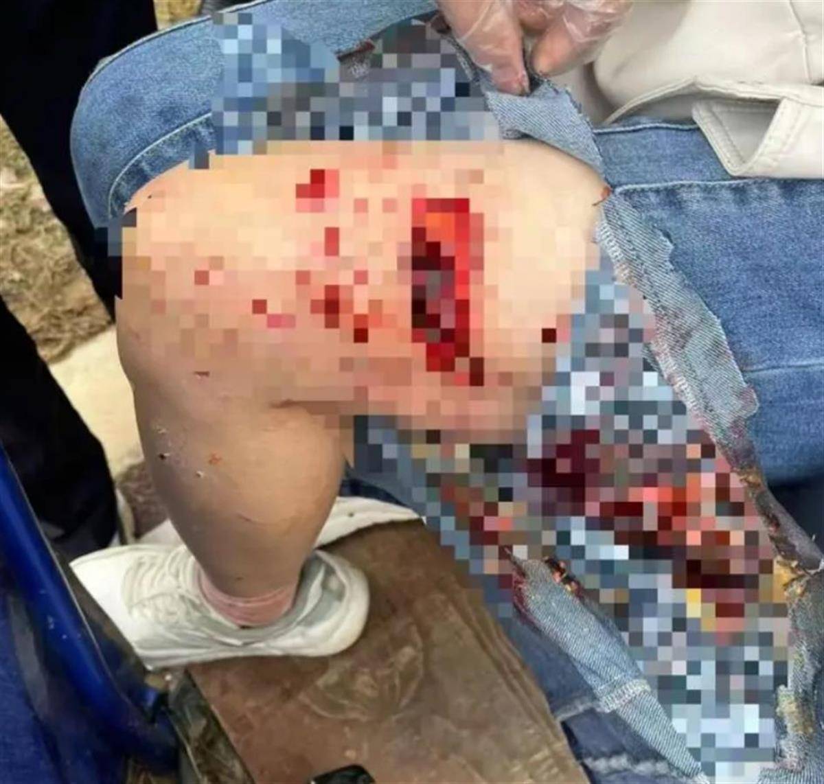 怎么注册皇冠信用网_撕咬母女的四条大型犬系杂交品种怎么注册皇冠信用网,律师:犬主若过失致人轻伤,不构成犯罪