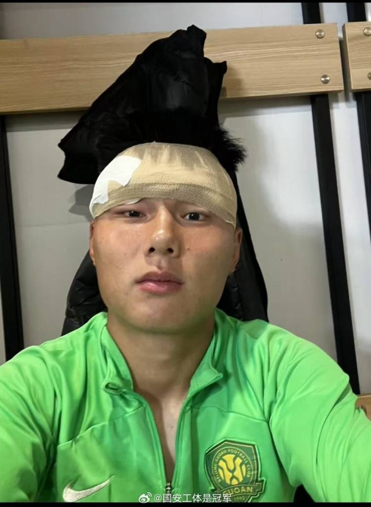 皇冠hga027_博主:国安冬训强度够激烈皇冠hga027,方昊训练场挂彩头缠绷带