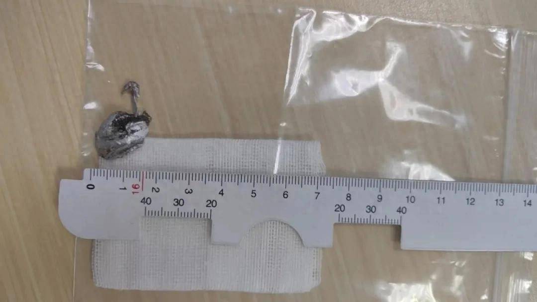 皇冠网址登录多少_700°C皇冠网址登录多少!浙江男子瞬间失明!紧急提醒