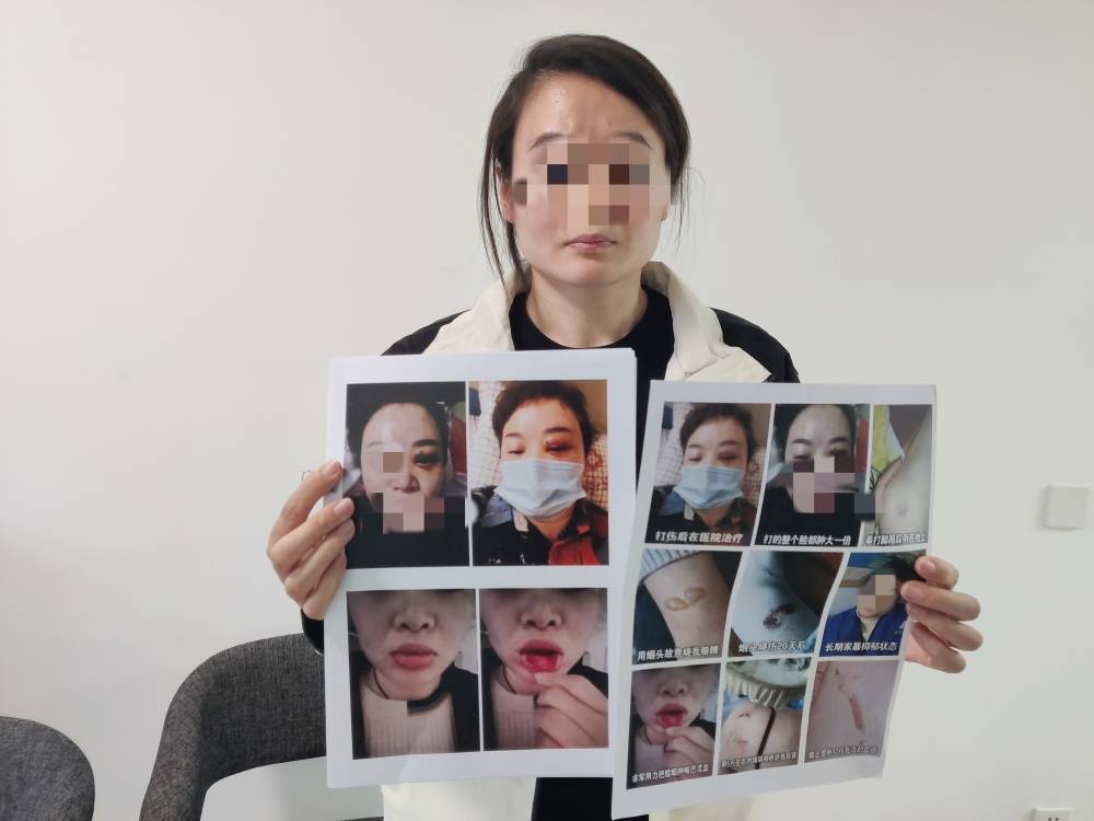 王者荣耀
_郑州一女子被企业家丈夫家暴最新进展:已要回孩子抚养权