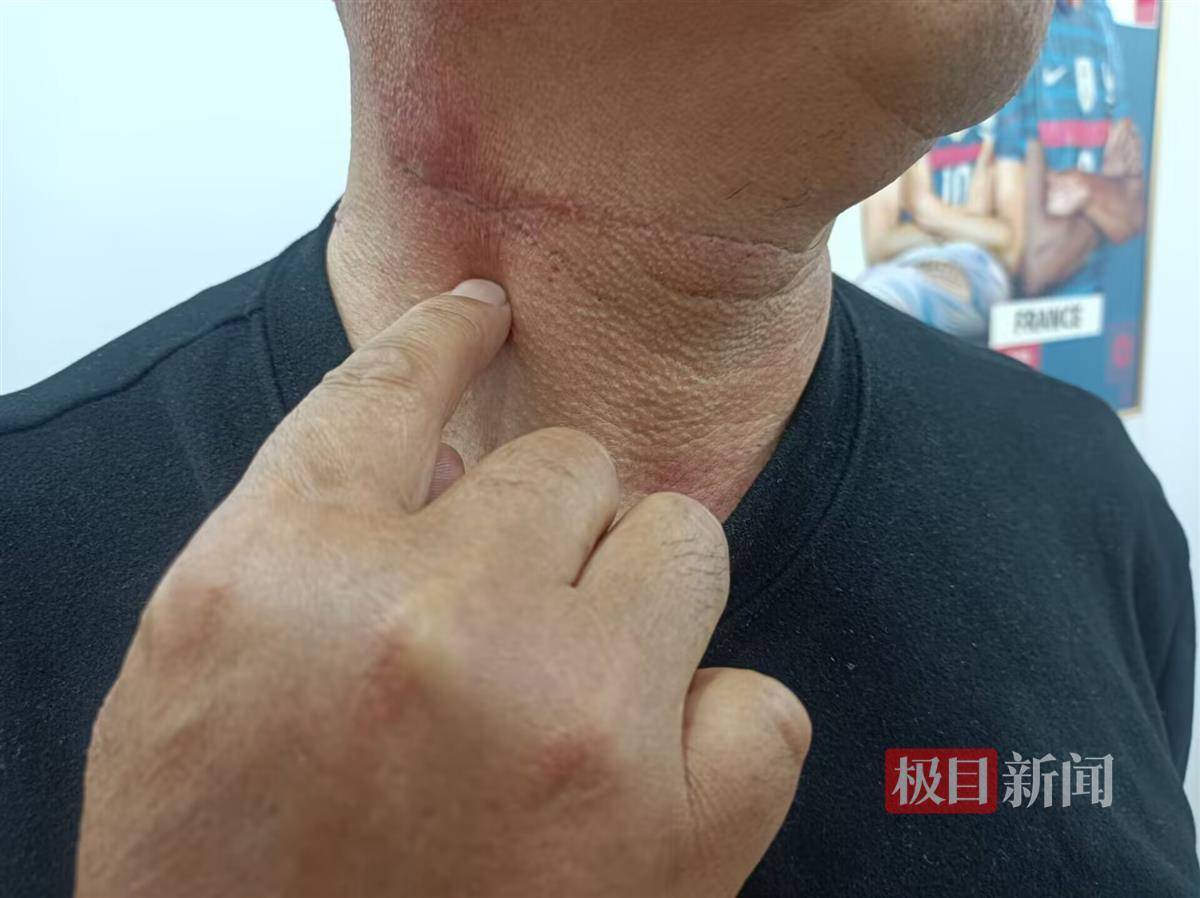 阿美尼亚超级联赛
_病房悲剧之谜:男子住院当晚捅伤同病房父子并跳楼身亡阿美尼亚超级联赛
,医院称其入院时无精神异常表现