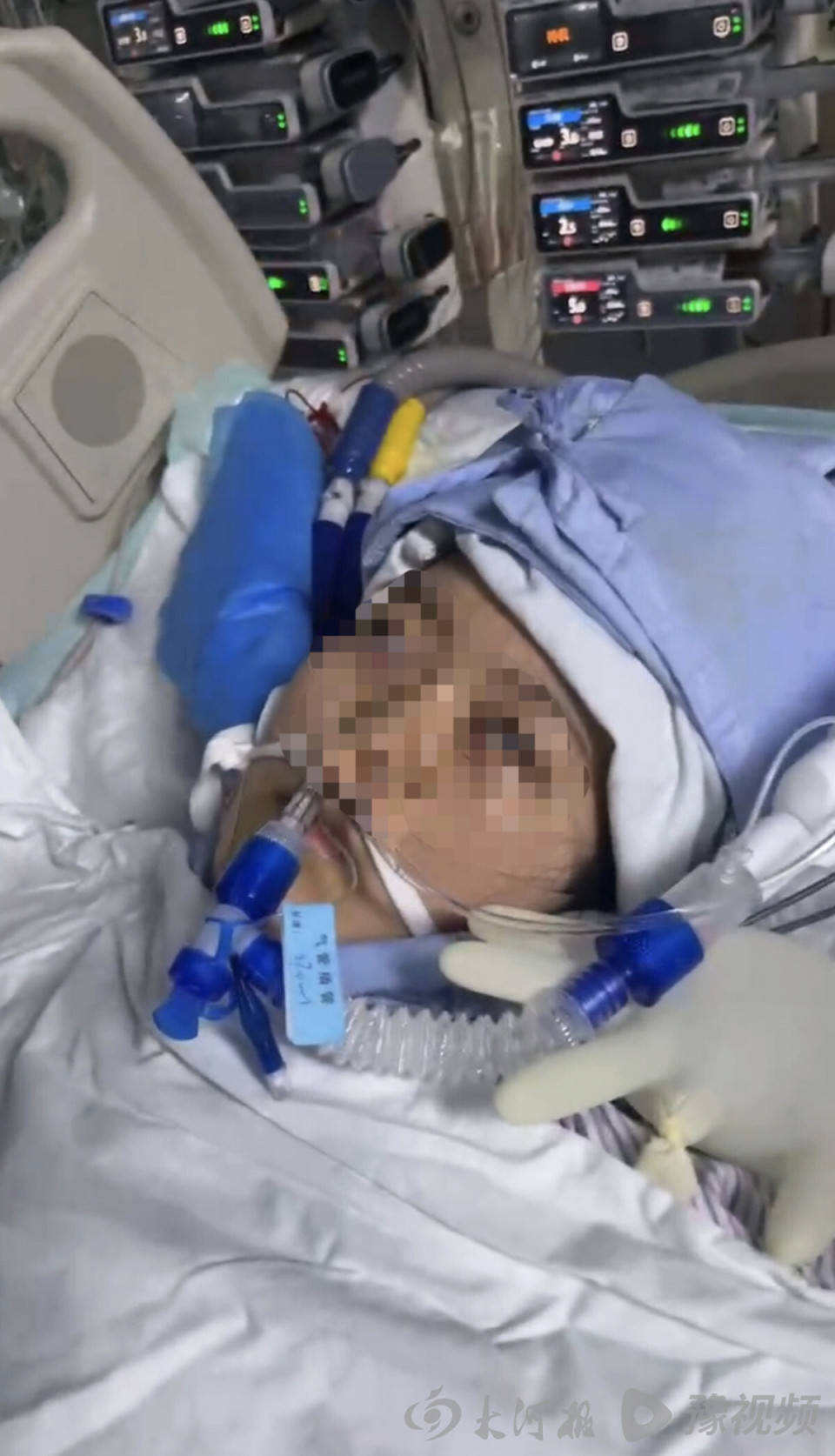 皇冠信用盘申请条件
_22岁美甲师手术成功却在复苏室脑死亡皇冠信用盘申请条件
,家属称缺氧30分钟监护医生未察觉,医院回应