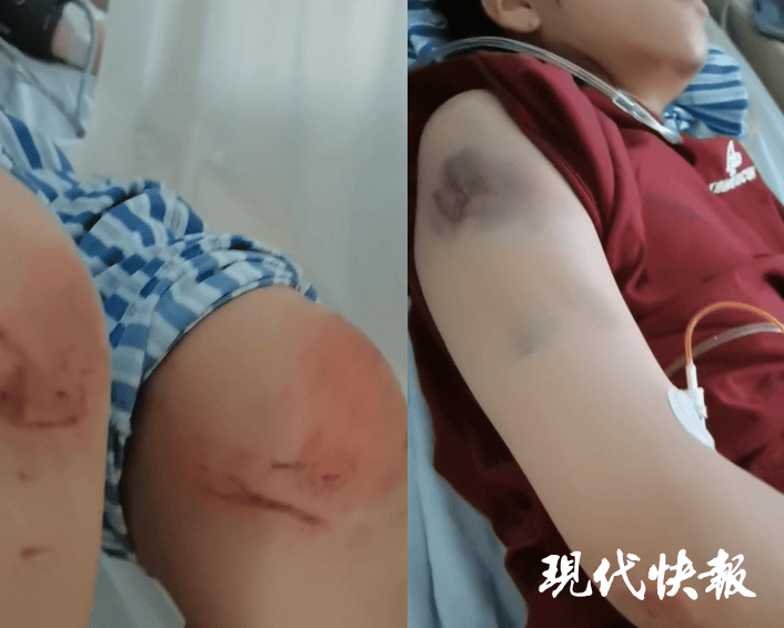 皇冠信用網APP下载
_石家庄被家暴女子驾车逃跑致丈夫身亡皇冠信用網APP下载
,一审以故意杀人罪获刑11年